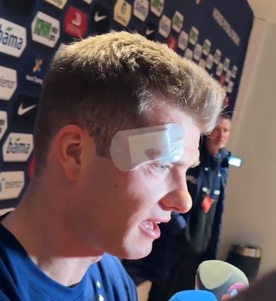 瑟尔洛特头部被撞后表示无碍:我没事,幸运的是没有脑震荡